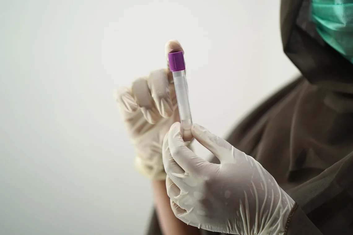 Biopsja prostaty: Wszystko, co musisz wiedzieć o badaniu