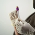 Biopsja prostaty: Wszystko, co musisz wiedzieć o badaniu